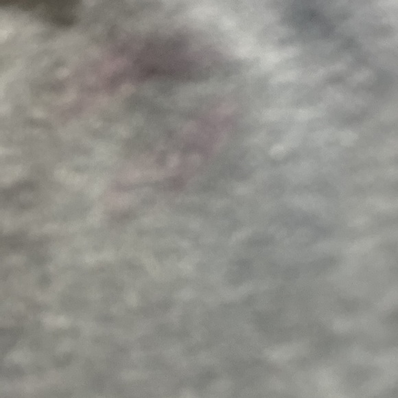 It’s to small - Picture 4 of 4